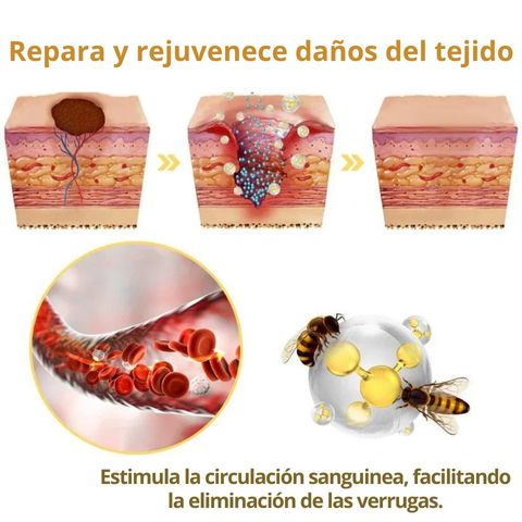 Spray Abeja Pura™ Elimina Marcas y Verrugas Fácil y Rápido