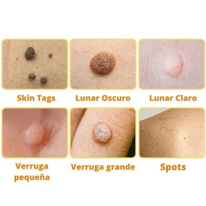 Spray Abeja Pura™ Elimina Marcas y Verrugas Fácil y Rápido