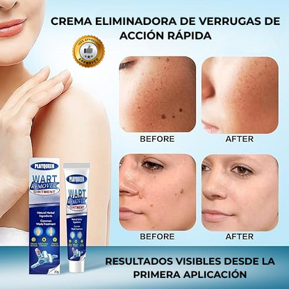 Adiós Verrugas™ | Fórmula Natural para una Piel Limpia y Segura