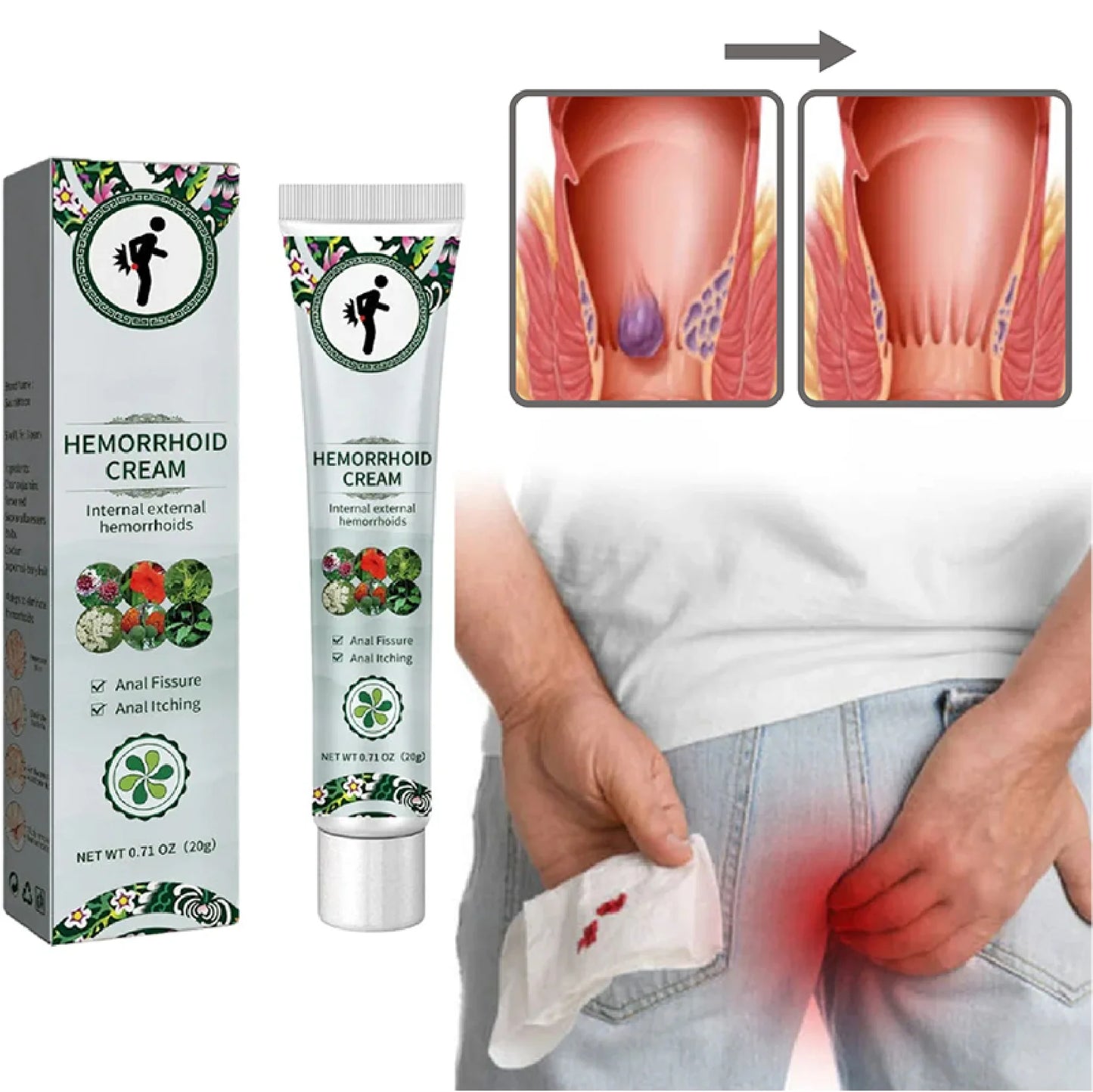 👩👨🌿 Crema Natural para el Alivio de las Hemorroides