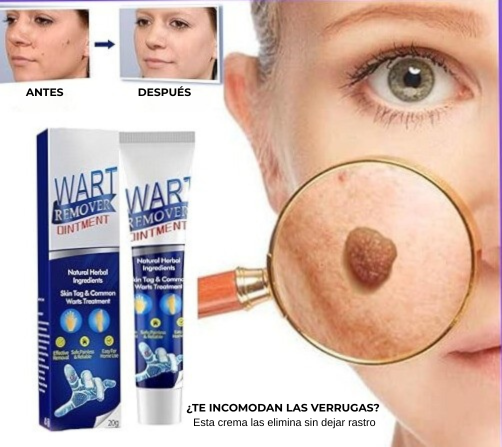 Adiós Verrugas™ | Fórmula Natural para una Piel Limpia y Segura